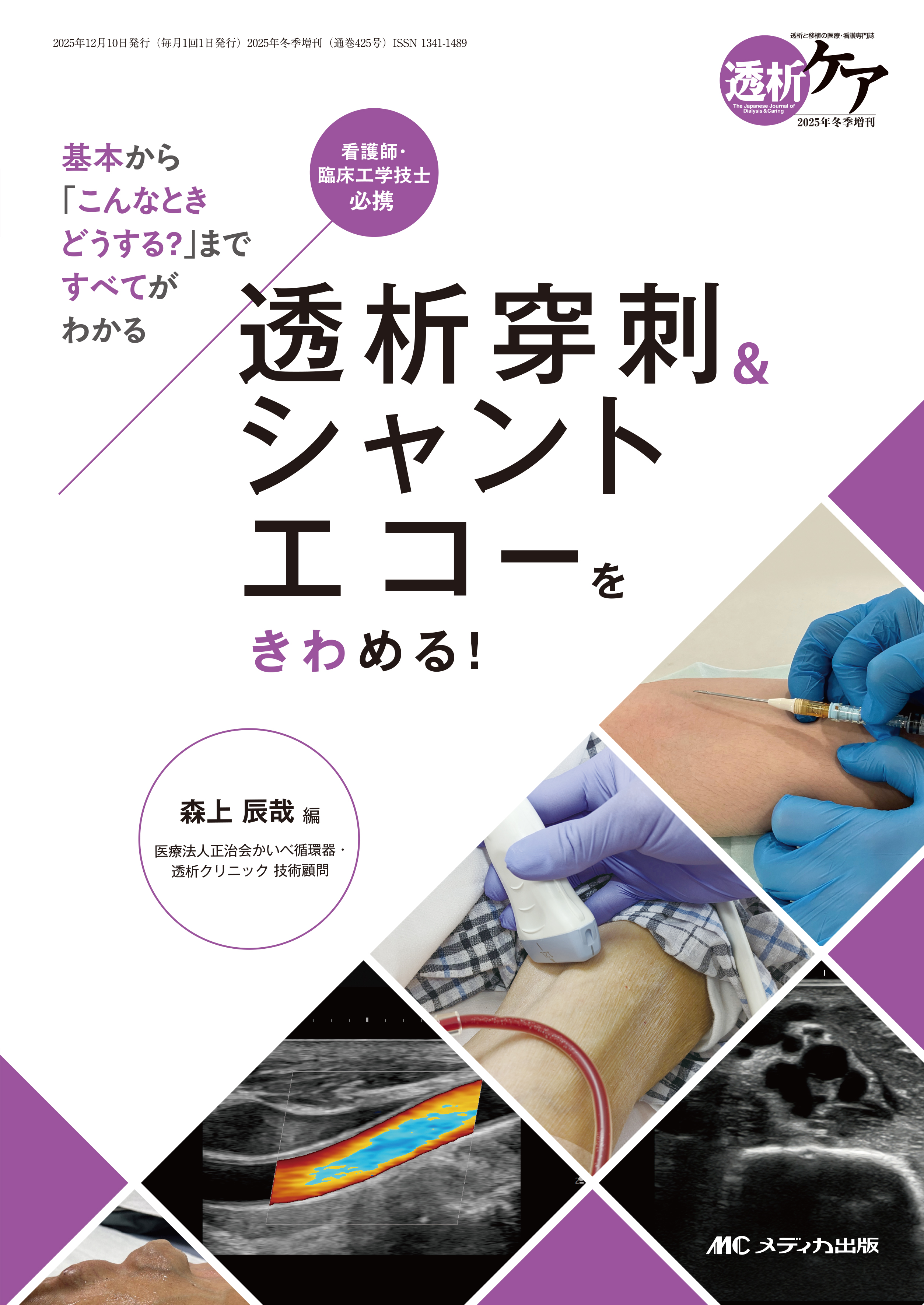 透析穿刺＆シャントエコーをきわめる！ | 医書.jp