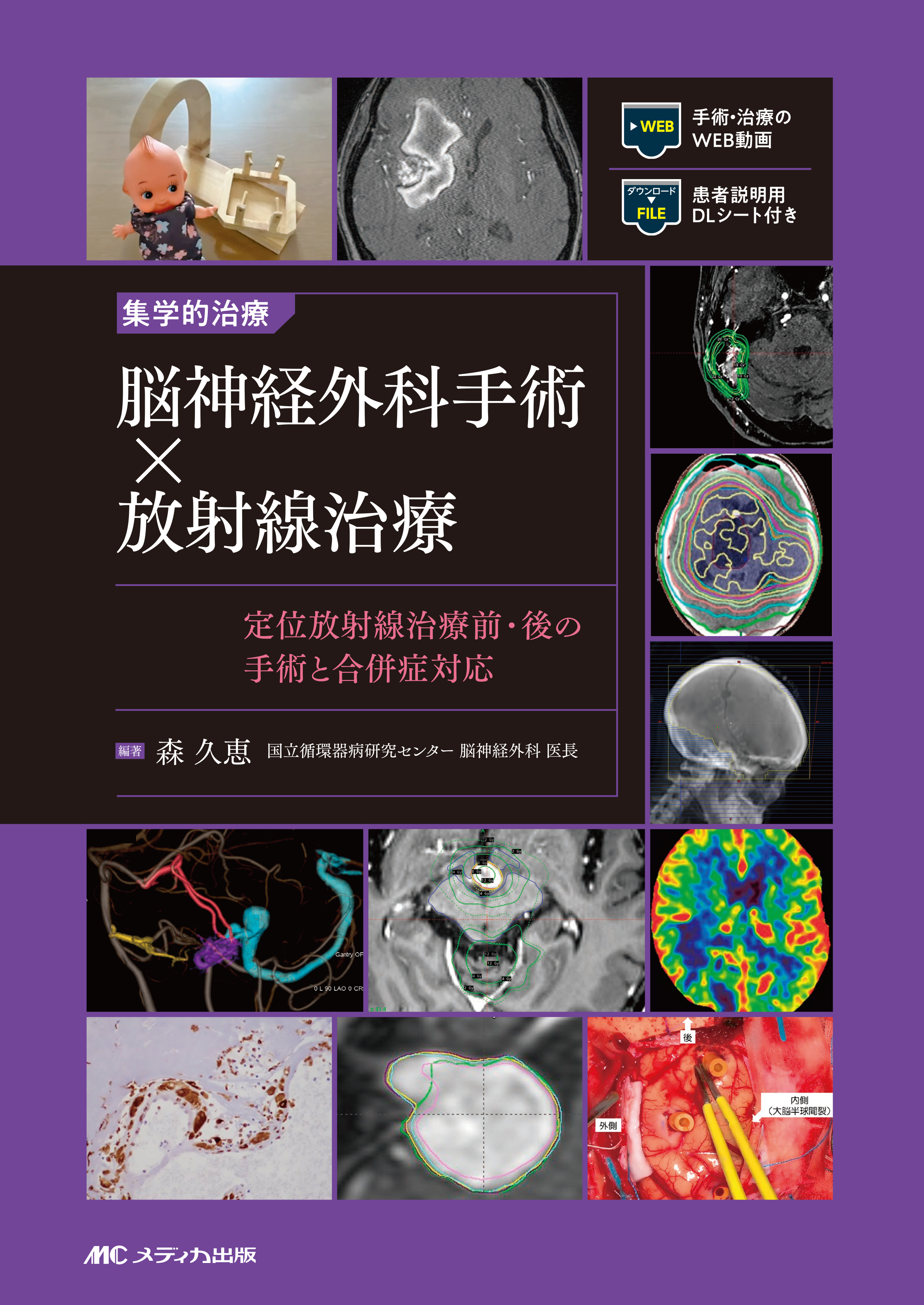 集学的治療 脳神経外科手術×放射線治療 | 医書.jp