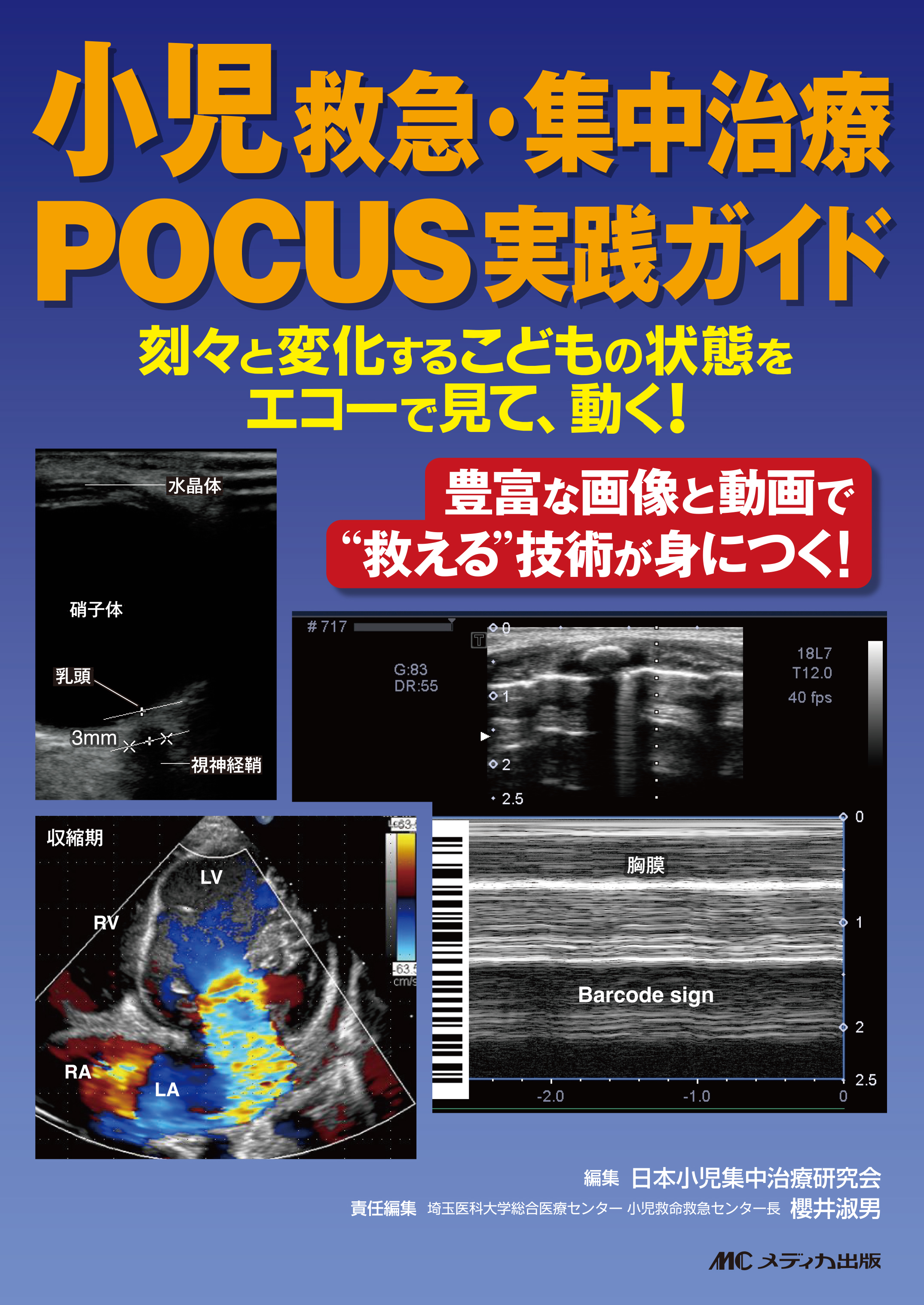 小児救急・集中治療POCUS実践ガイド | 医書.jp