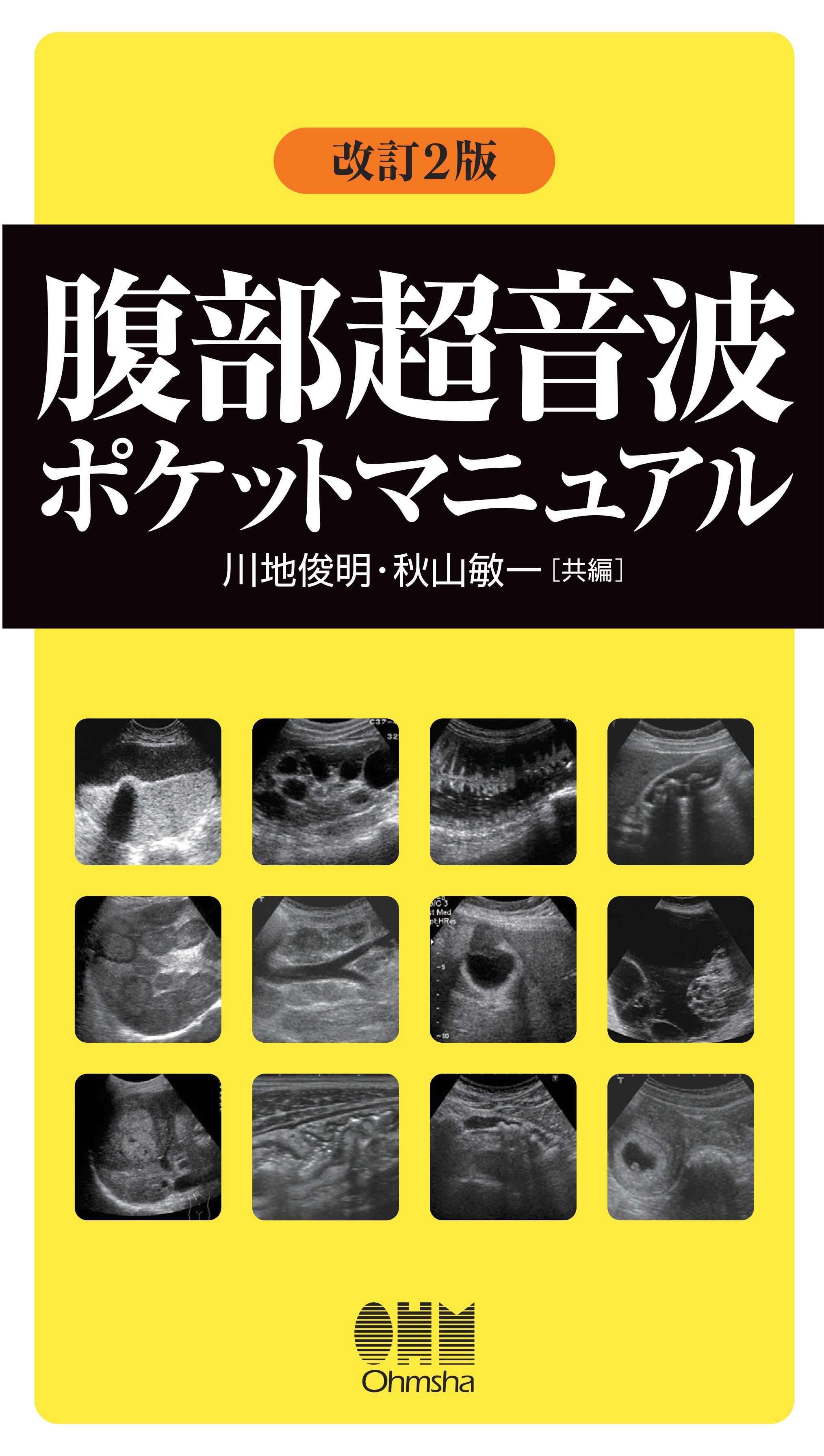 腹部超音波ポケットマニュアル （改訂2版） | 医書.jp