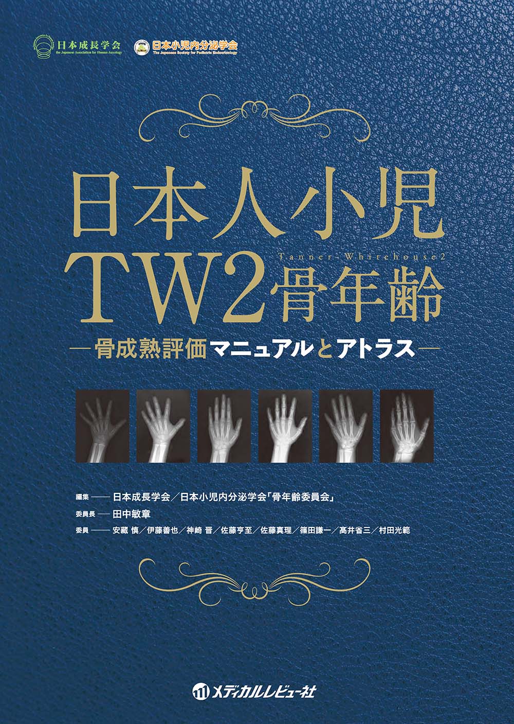日本人小児TW2骨年齢—骨成熟評価マニュアルとアトラス— | 医書.jp