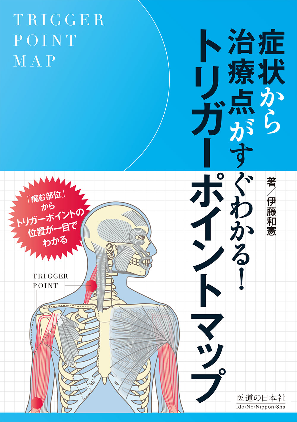 症状から治療点がすぐわかる！トリガーポイントマップ | 医書.jp