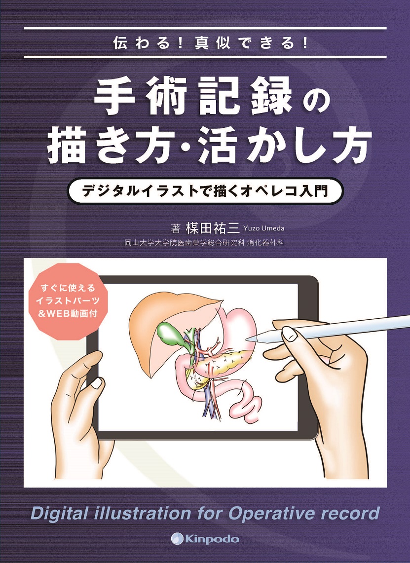 伝わる！真似できる！手術記録の描き方・活かし方 デジタルイラストで