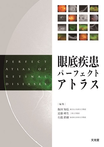 眼底疾患パーフェクトアトラス | 医書.jp