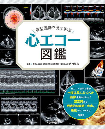 心エコー図鑑 | 医書.jp