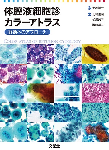 体腔液細胞診カラーアトラス | 医書.jp