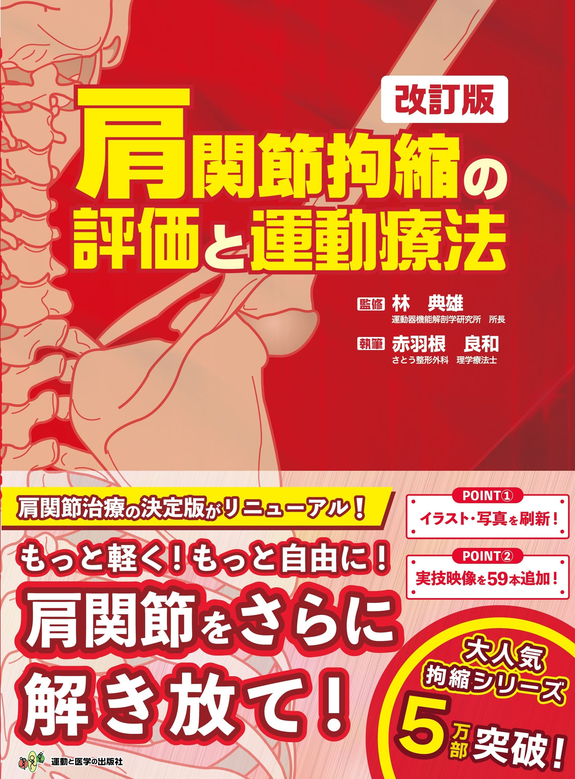 肩関節拘縮の評価と運動療法 改訂版 | 医書.jp