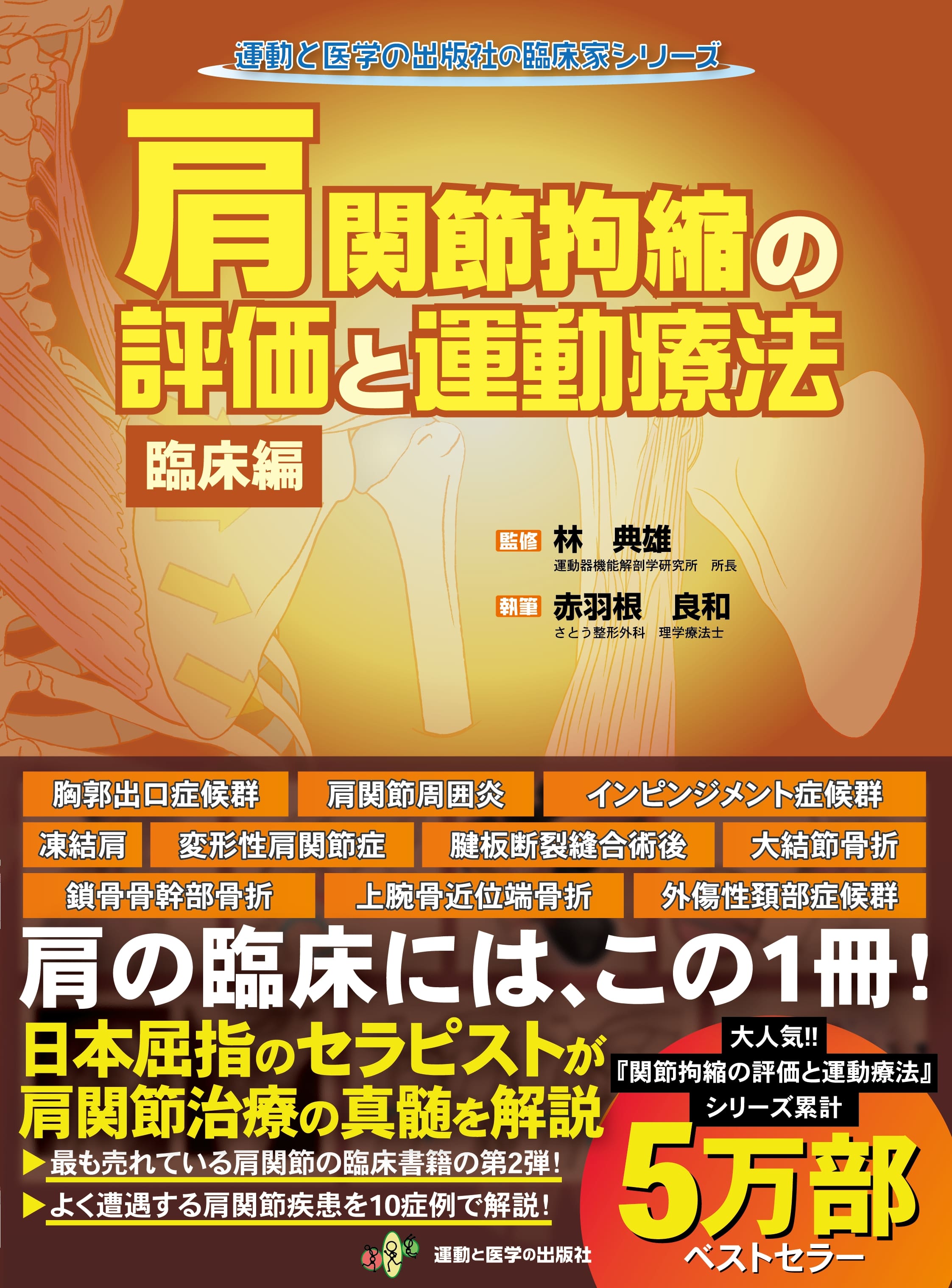 肩関節拘縮の評価と運動療法 臨床編 | 医書.jp